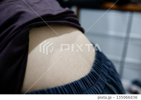 女性の背中、腰部分に生えるムダ毛の状態 女性の背中、腰部分に生えるムダ毛の状態 135066836