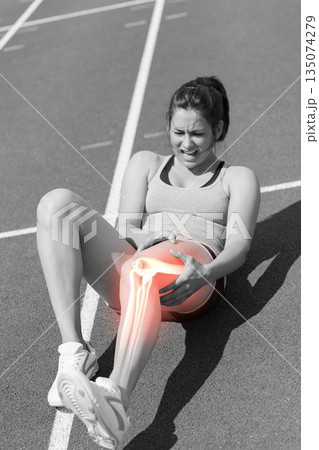 Highlighted bones of injured woman 135074279