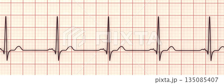 P-mitrale, 3D illustration P-mitrale, 3D illustration 135085407