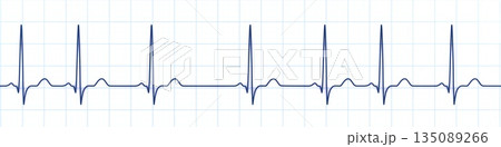 Respiratory sinus arrhythmia, 3D illustration Respiratory sinus arrhythmia, 3D illustration 135089266
