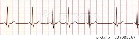 Respiratory sinus arrhythmia, 3D illustration 135089267