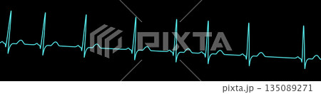 Respiratory sinus arrhythmia, 3D illustration Respiratory sinus arrhythmia, 3D illustration 135089271