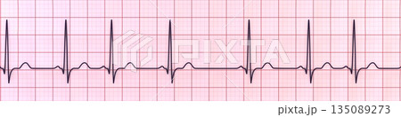 Respiratory sinus arrhythmia, 3D illustration Respiratory sinus arrhythmia, 3D illustration 135089273