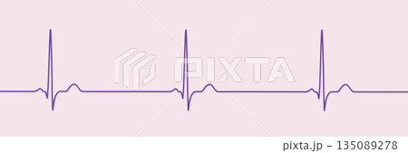 Sinus bradycardia, 3D illustration 135089278