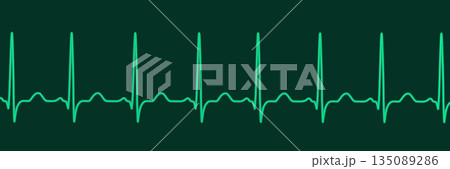 Sinus tachycardia, 3D illustration 135089286