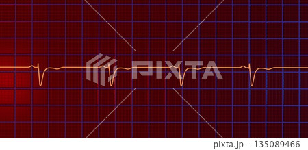 Normal ECG in V1-V2, 3D illustration Normal ECG in V1-V2, 3D illustration 135089466