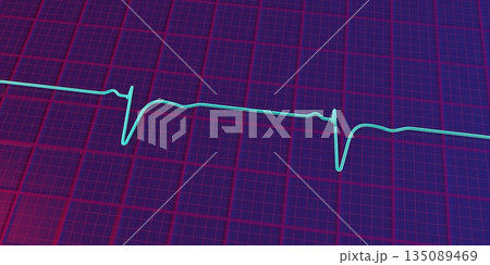 Normal ECG in V1-V2, 3D illustration Normal ECG in V1-V2, 3D illustration 135089469