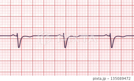 Normal ECG in V1-V2, 3D illustration 135089472