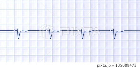 Normal ECG in V1-V2, 3D illustration Normal ECG in V1-V2, 3D illustration 135089473