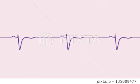 Normal ECG in V1-V2, 3D illustration 135089477
