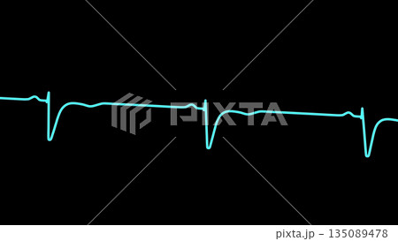 Normal ECG in V1-V2, 3D illustration Normal ECG in V1-V2, 3D illustration 135089478