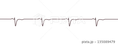 Normal ECG in V1-V2, 3D illustration 135089479