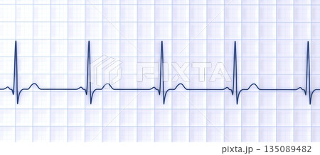 Normal ECG, 3D illustration Normal ECG, 3D illustration 135089482