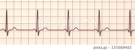 Normal ECG, 3D illustration 135089483