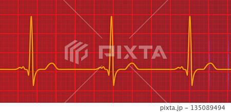 P-mitrale, 3D illustration P-mitrale, 3D illustration 135089494