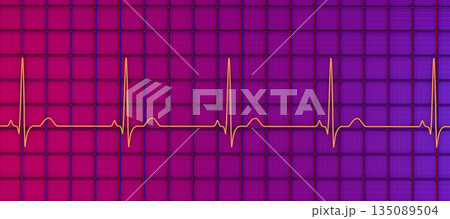 P-pulmonale, 3D illustration P-pulmonale, 3D illustration 135089504
