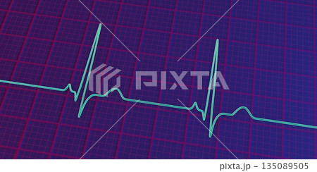 P-pulmonale, 3D illustration P-pulmonale, 3D illustration 135089505