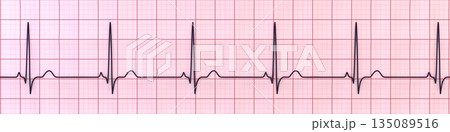 P-pulmonale, 3D illustration P-pulmonale, 3D illustration 135089516