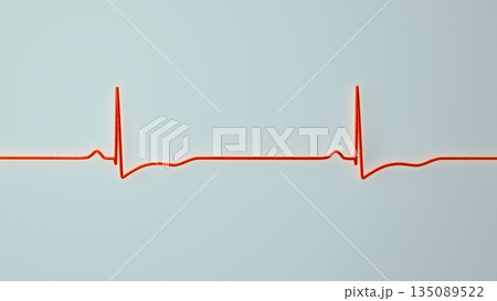 Right ventricular hypertrophy, 3D illustration 135089522
