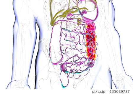 Human digestive system with highlighted descending colon, 3D illustration 135089787