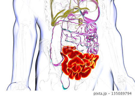 Ileum, 3D illustration Ileum, 3D illustration 135089794
