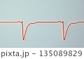 Left ventricular hypertrophy, 3D illustration 135089829