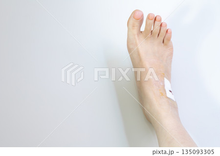 絆創膏を貼った女性の足 135093305