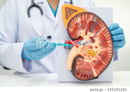 Kidney disease, Chronic kidney disease ckd, Doctor hold human model to treat and study in hospital. Kidney disease, Chronic kidney disease ckd, Doctor hold human model to treat and study in hospital. 135101282