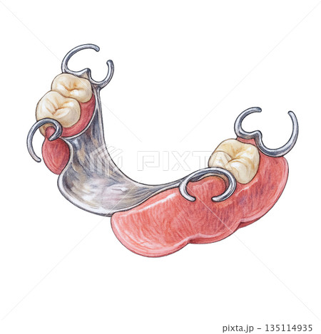部分入れ歯イラスト 背景透過の歯科医療素材 135114935