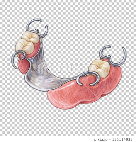 部分入れ歯イラスト 背景透過の歯科医療素材 135114935