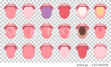 舌部狀況插圖資料集 135146309