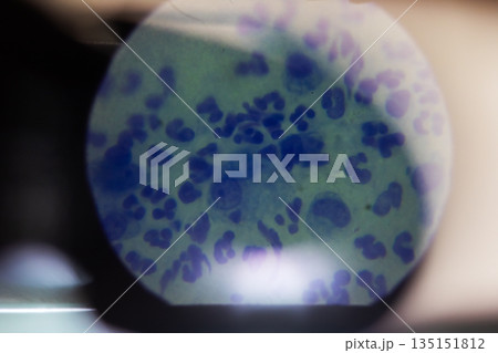 Thorough microscopic examination emphasizing leukocyte characteristics with background shading 135151812