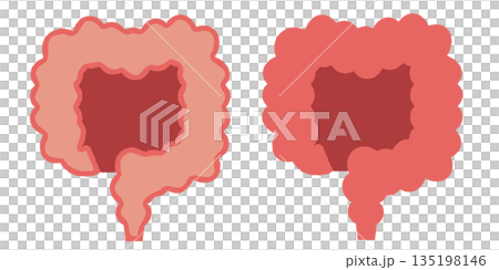 大腸とその断面図のイラスト 135198146