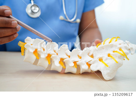 Asian doctor holding spinal nerve and bone model, Lumbar spine displaced herniated disc fragment for treatment medical in the orthopedic department. 135209617