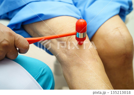 Asian doctor knock on knee reflex nerve for check and treatment senior patient in hospital. 135213018