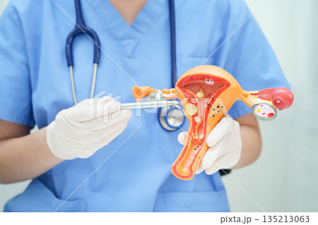 Uterus, doctor holding human anatomy model for study diagnosis and treatment in hospital. 135213063