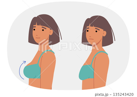 Woman had plastic surgery for breasts, inserting implants to increase size or improve firmness Woman had plastic surgery for breasts, inserting implants to increase size or improve firmness 135243420