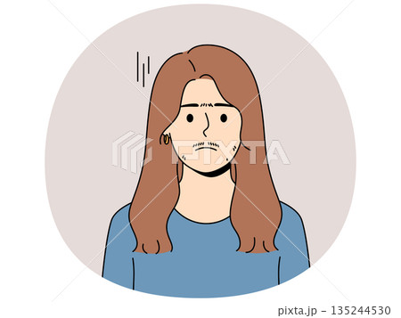 Woman suffering from hirsutism, which causes growth mustache and thick eyebrows on face Woman suffering from hirsutism, which causes growth mustache and thick eyebrows on face 135244530