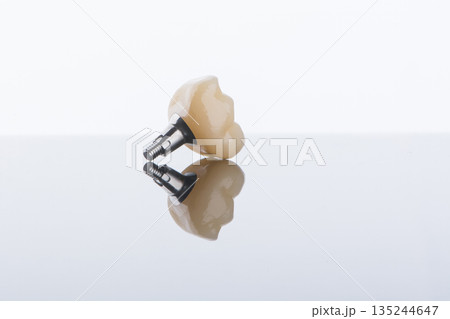 Single dental crown of molar with individual titanium abutment for fixation on implant. Single dental crown of molar with individual titanium abutment for fixation on implant. 135244647