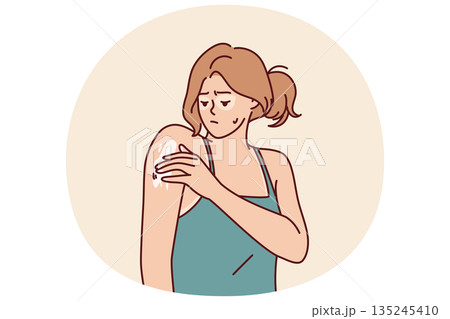 Woman with sunburn applies healing cream on shoulder to repair skin after exposure to ultraviolet 135245410