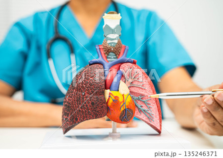 Pneumonia, lung cancer, Asian doctor holding human anatomy model for study diagnosis and treatment in hospital. 135246371