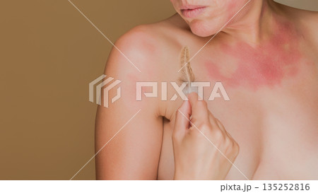 Woman experiencing skin allergy or irritation from feather 135252816