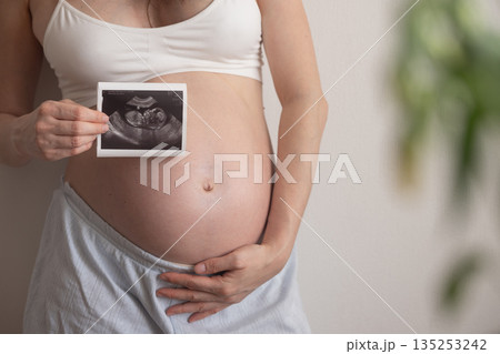 Pregnant woman showing ultrasound scan of baby Pregnant woman showing ultrasound scan of baby 135253242