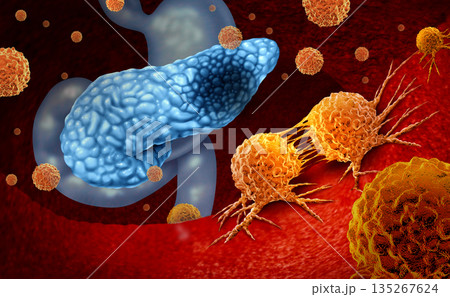 Lung Cancer Lung Cancer 135267624