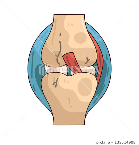 illustration of joint pain illustration of joint pain 135314909