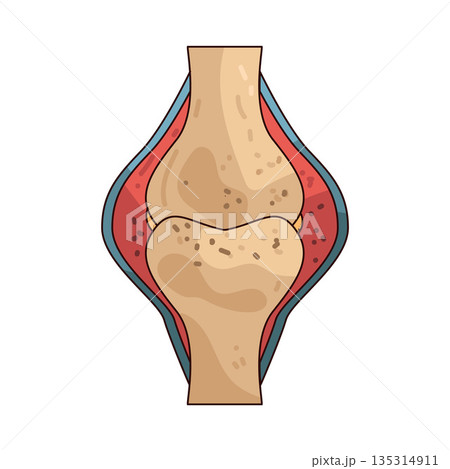 illustration of joint pain illustration of joint pain 135314911