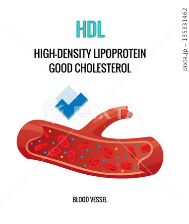 Type of cholesterol in human blood vessels. Normal artery for explanation disease. High-Density Lipoprotein HDL. Vector illustration Type of cholesterol in human blood vessels. Normal artery for explanation disease. High-Density Lipoprotein HDL. Vector illustration 135331462
