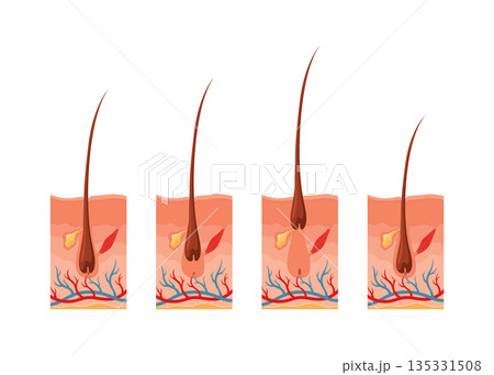 Hair growth cycle. Follicles phase. Anagen, Catagen and Telogen of hair bulbs phase. Human hair follicle anatomy. Cross section of layers of the skin Hair growth cycle. Follicles phase. Anagen, Catagen and Telogen of hair bulbs phase. Human hair follicle anatomy. Cross section of layers of the skin 135331508