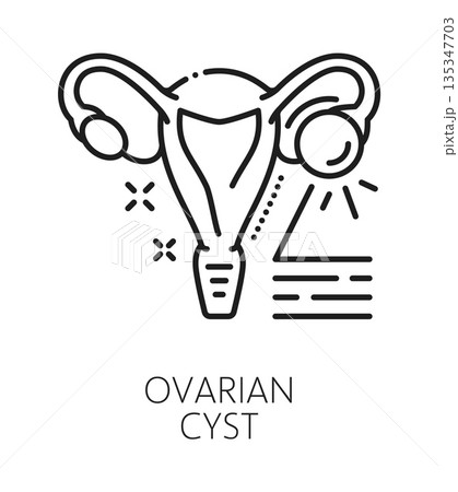 Ovarian cyst gynecology, fertility and medical line icon or label. Gynecology problem or disease, woman fertility icon, pregnancy medicine vector symbol. Urinary healthcare sign with sick uterus organ Ovarian cyst gynecology, fertility and medical line icon or label. Gynecology problem or disease, woman fertility icon, pregnancy medicine vector symbol. Urinary healthcare sign with sick uterus organ 135347703