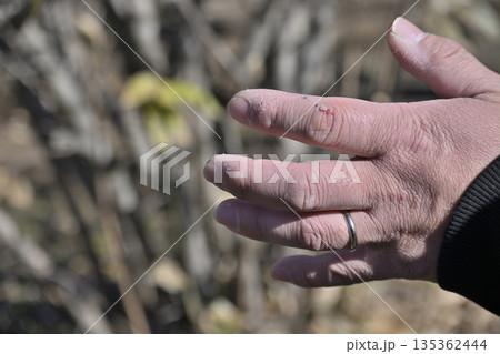 手荒れがひどい男性の手 手荒れがひどい男性の手 135362444